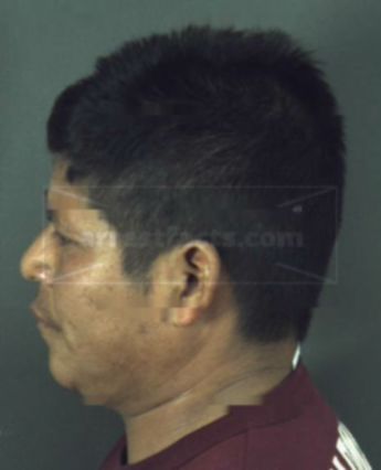 Roberto Lopez-Vasquez