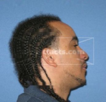 Vernon Clay