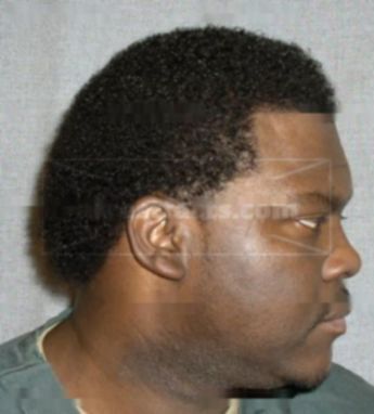 Anthony Pearson