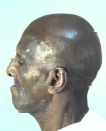 Hubert B Brown