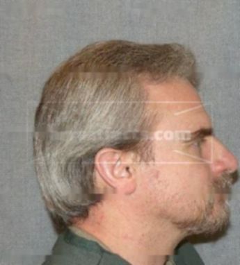 Jeffrey L Bird