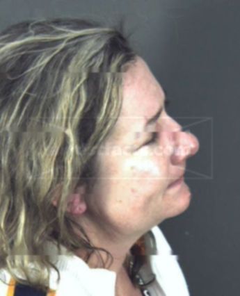 Cynthia Dehart Sullivan