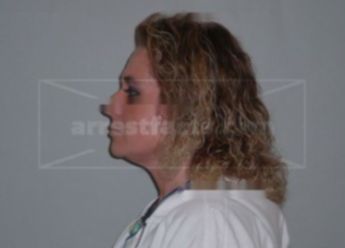 Tammie A Krause