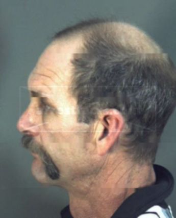 Randall Norman Eskew