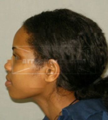 Latoya J Fields