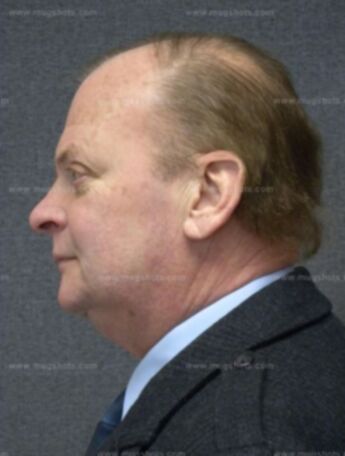 Thomas E Krenzelok