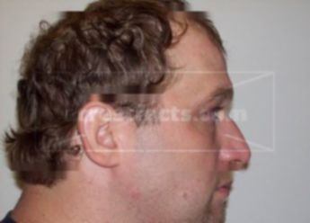 Heath J Pitts