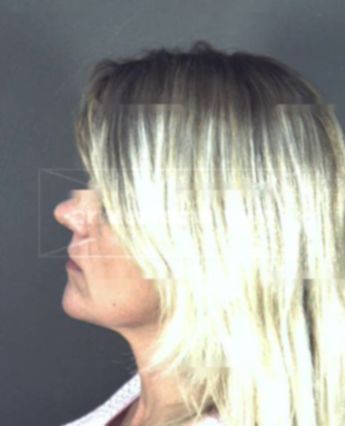 Jill Ann Downs