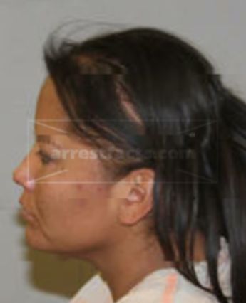 Alfreida Simpson