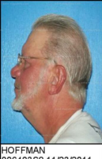 Gary Lee Hoffman