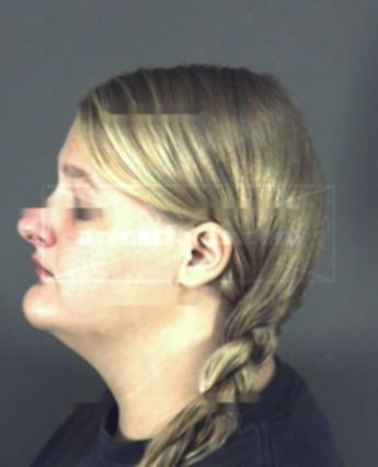 Ashlynn Taylor Hunter