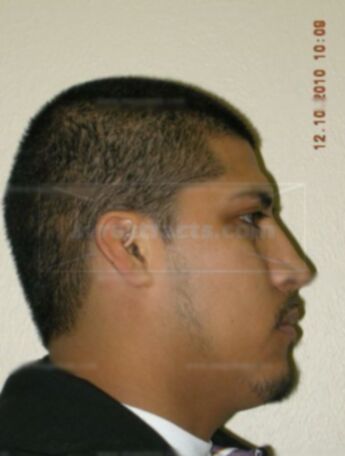 Anthony Espinoza