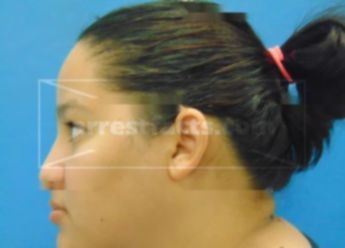 Pamel Saaveda Gonzales