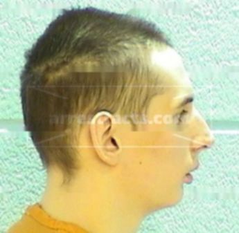 Adam Harrison