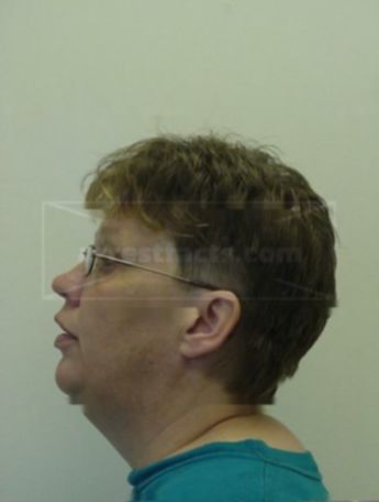 Lynnda L Farrell