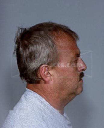 Gregory George Oneil