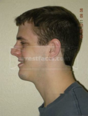 Kevin P Arend