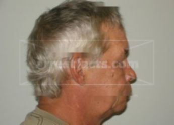 Randy A Jacobson