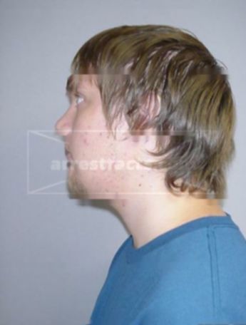 Chad D Britz