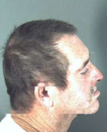 Troy Kenneth Patterson