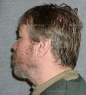 William F Boetcher