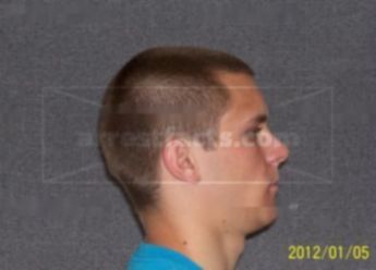 Mitchell R Clements
