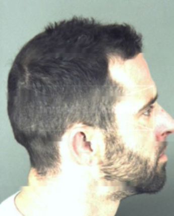 Brian Chad Teate