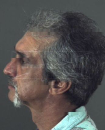 Tony Curtis Yohe