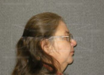 Bernice A Heimann