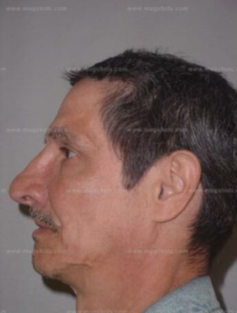 Elkin D Gomez