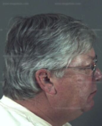 Thomas Fogleman