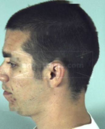 Timothy Keith Lightfoot