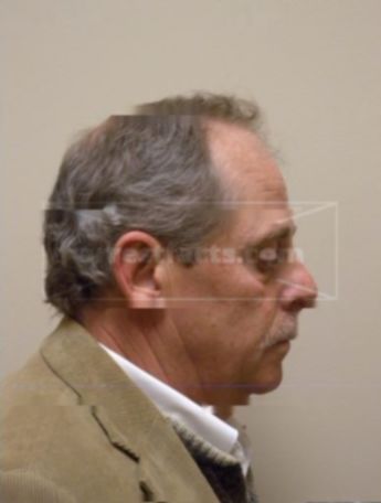 Ronald A Foster