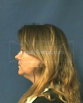 Rhonda L Collins