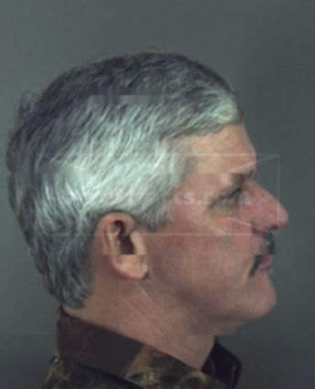 Charles D Baker