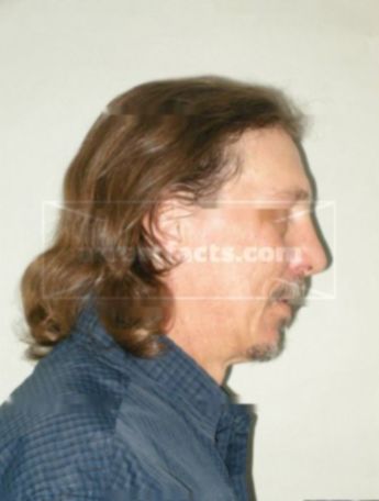 Rodney L Osbern