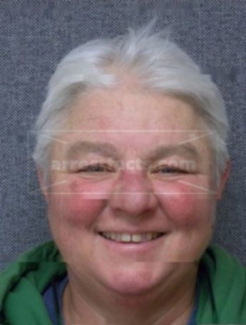 Karin Kanton