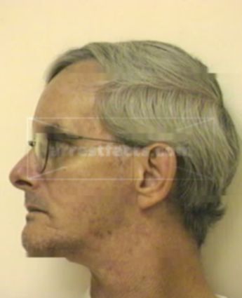 Richard Anthony Accaputo