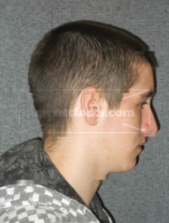Dylan J Henze