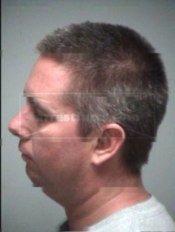 Jerome Kenneth Zacher