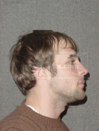 Eric D Weyker