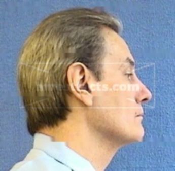 Randy Brackett