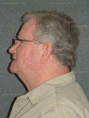 Glen R Collins