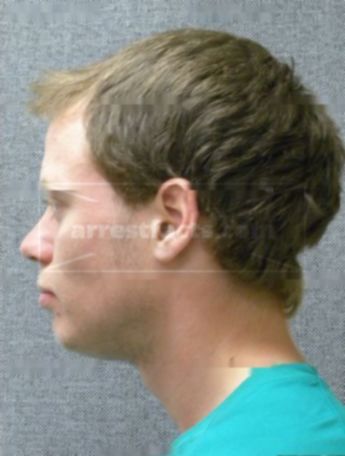 Austin J Frenzel