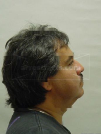 Roberto M Palacios