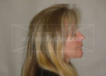 Traci M Cotterell