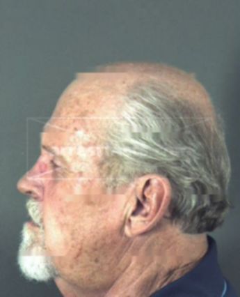Larry Dale Nickerson