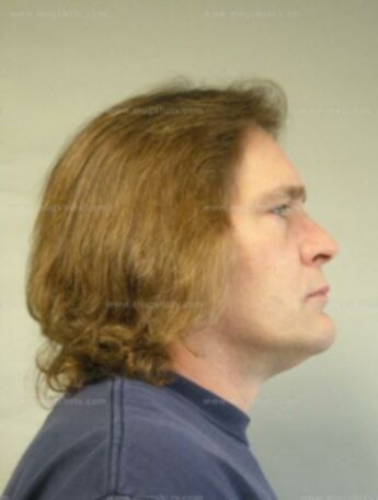 Michael J Hanson