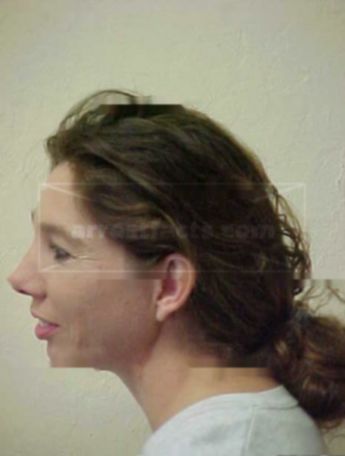 Suzanne R Gaffney