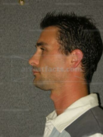 Aaron R Sachse
